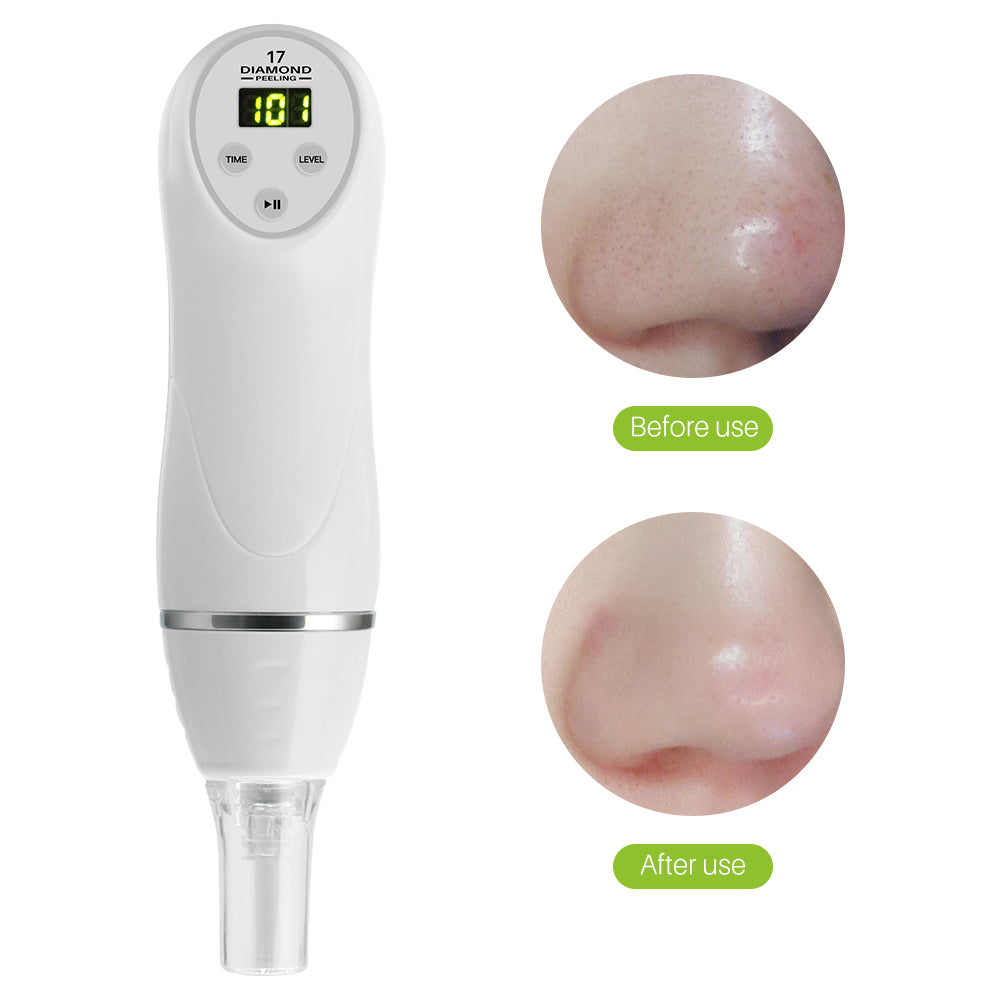 Electric pore suction and acne removing device beauty cleaner